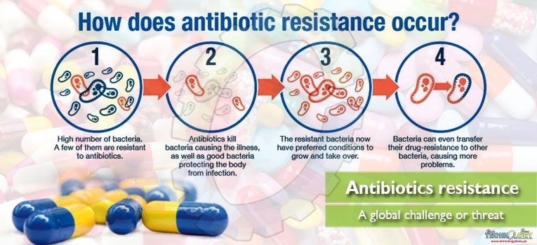 Antibiotics resistance A global challenge or threat