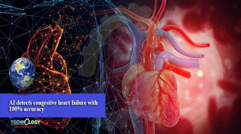 AI detects congestive heart failure with 100% accuracy