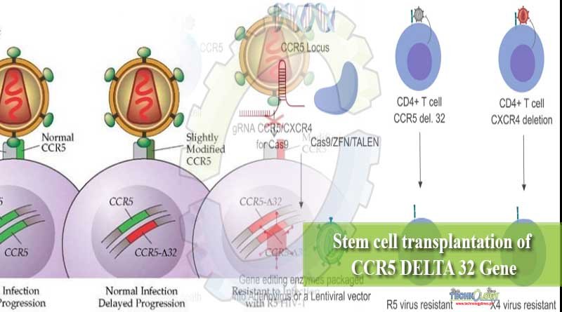 Stem cell transplantation of CCR5 DELTA 32 Gene