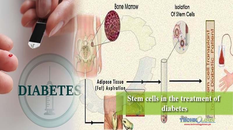 Stem cells in the treatment of diabetes