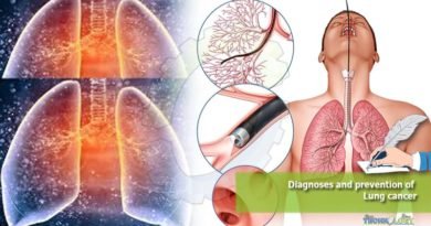 Diagnoses and prevention of Lung cancer