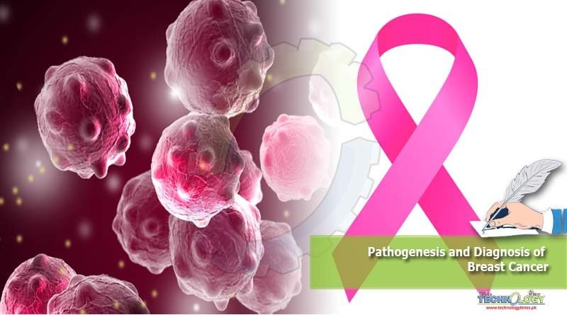 Pathogenesis and Diagnosis of Breast Cancer