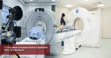 CT-Scan-New-Technique-Reduces-Radiation-Dose-UCL-Research