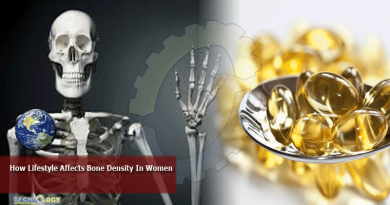 How Lifestyle Affects Bone Density In Women