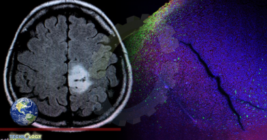 Molecular reporters expose the allies of the brain tumor