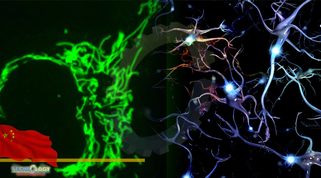 Tech It Out: Fluorescent probes help visualize live brain cells