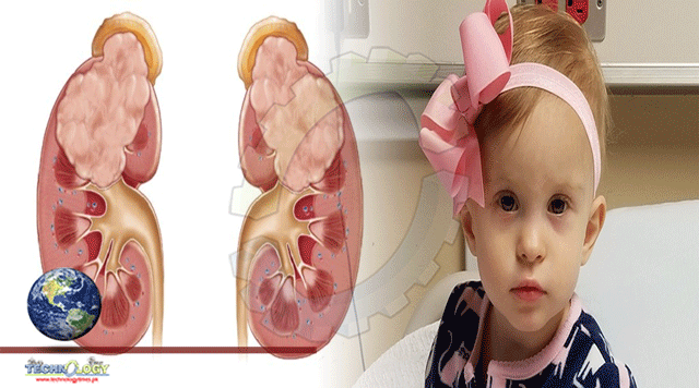 Neuroblastoma cancer is responsible for 15% of childhood deaths 