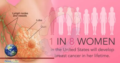 why women get breast cancer