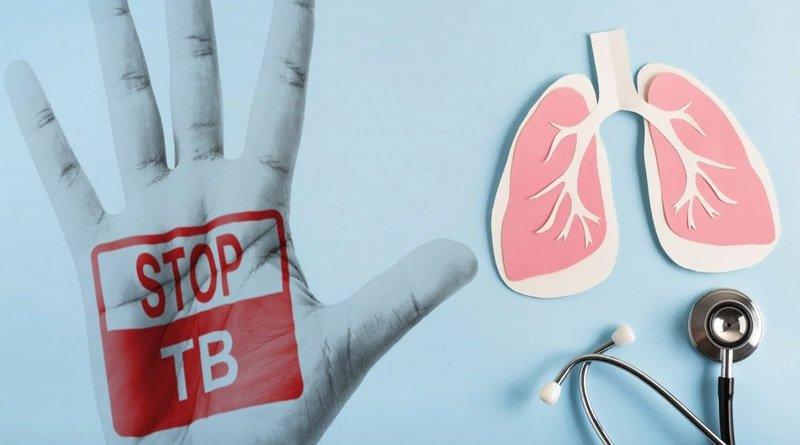 All Citizens' Screening Must To End TB In Pakistan: Minister